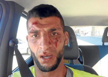 agresion-otman-residente-ceti