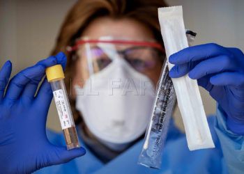 pruebas-coronavirus