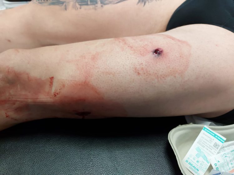 aegc-chalecos-antibalas-guardia-civil-1