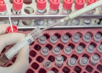 PCR-prueba-coronavirus
