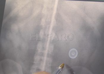 radiografia-guardia-civil-drogas