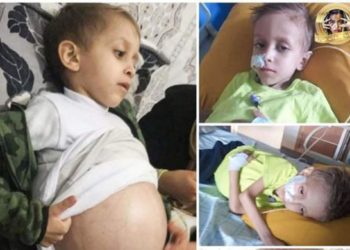 niño-tetuani-cancer