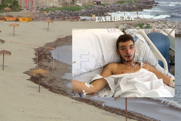 agredido-playa-ribera