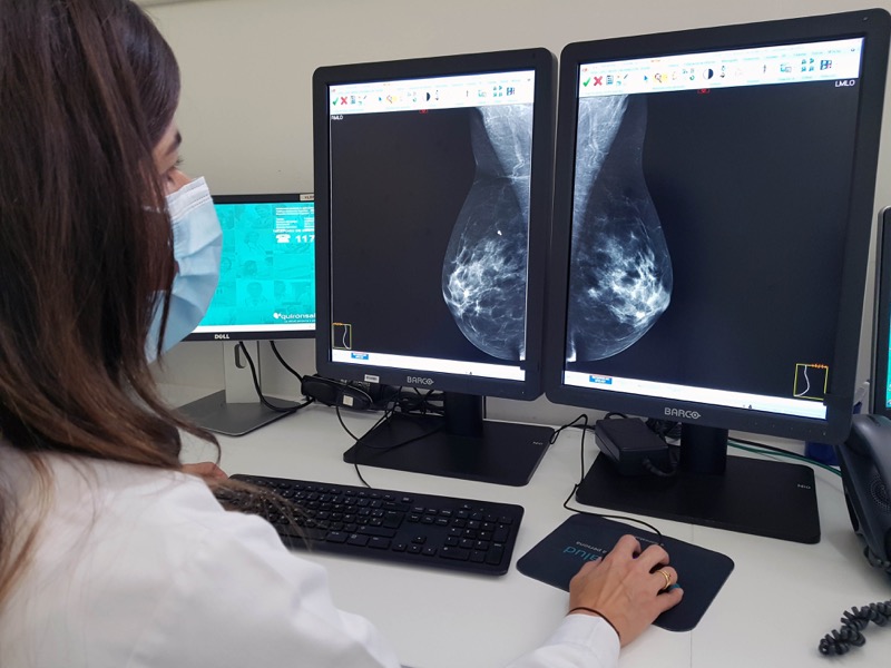 mamografia-cancer-mama-001