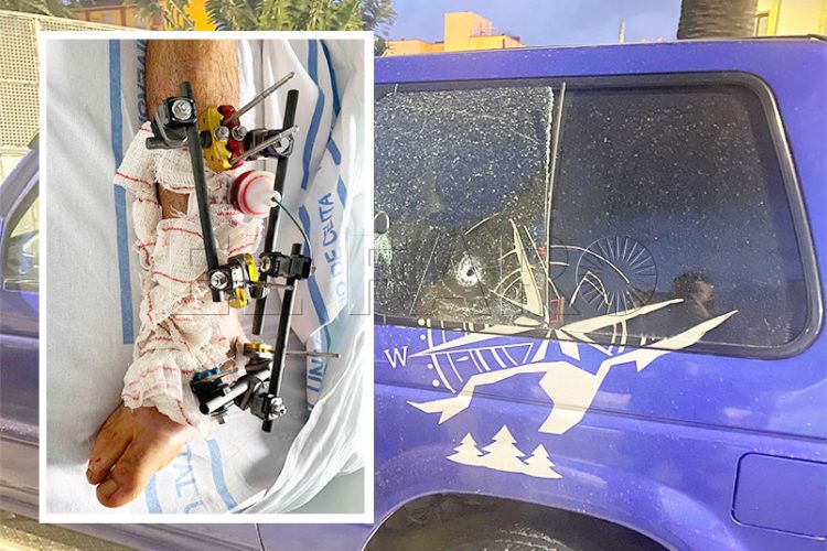 disparo-pierna-coche