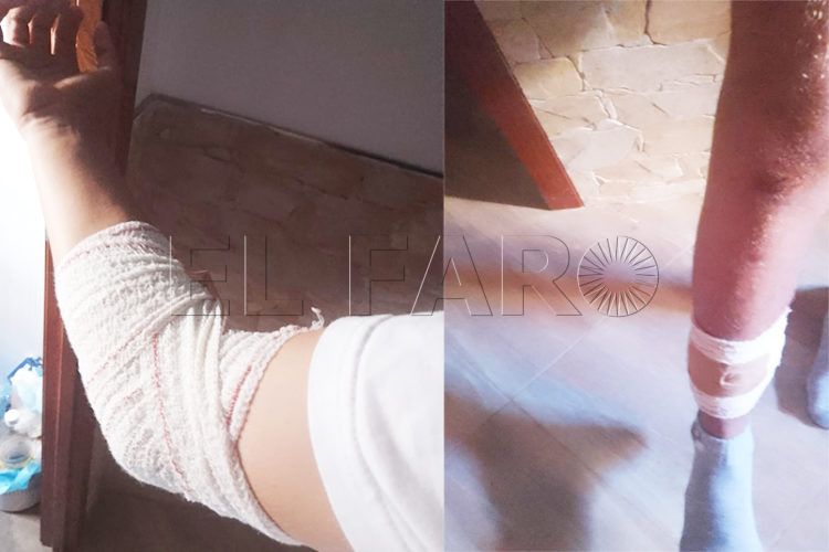 victima-mordedura-perros