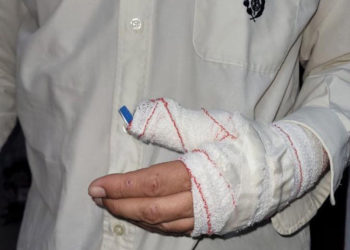 tampm-agresion-funcionario-prisiones-ceuta-1