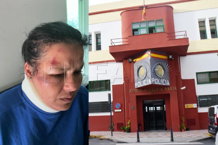 mujer-brutal-paliza-loma-colmenar-denuncia