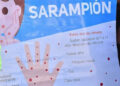 brote-sarampion-detectado-tenerife