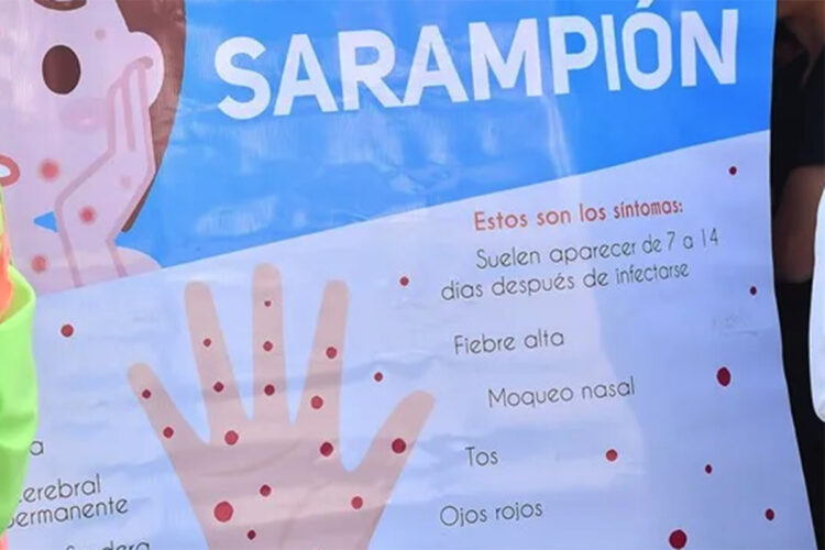 sarampion-no-causa-grandes-estragos-ceuta