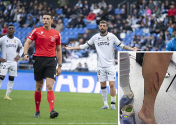 asi-quedo-pierna-cristian-entrada-villares