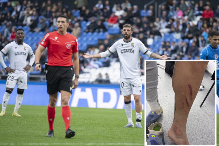 asi-quedo-pierna-cristian-entrada-villares