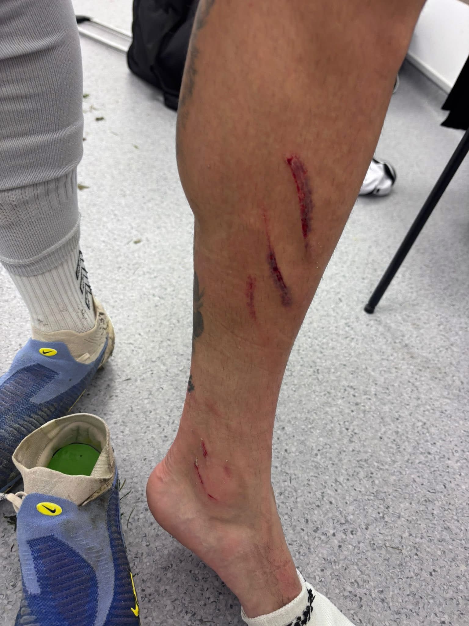 pierna-cristian-jugador-ad-ceuta-encuentro-deportivo-coruna