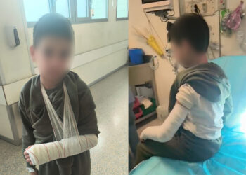 hijo-estuvo-hora-dolor-madre-pide-enfermera-todos-dias-jose-acosta