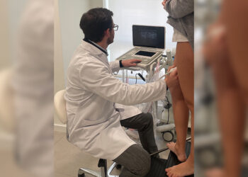 varices-poblacion-adulta-prevenirse-habitos-saludables-2