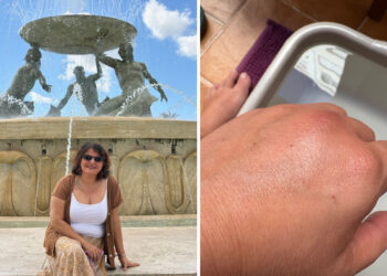 lyme-picadura-pone-vida-pausa