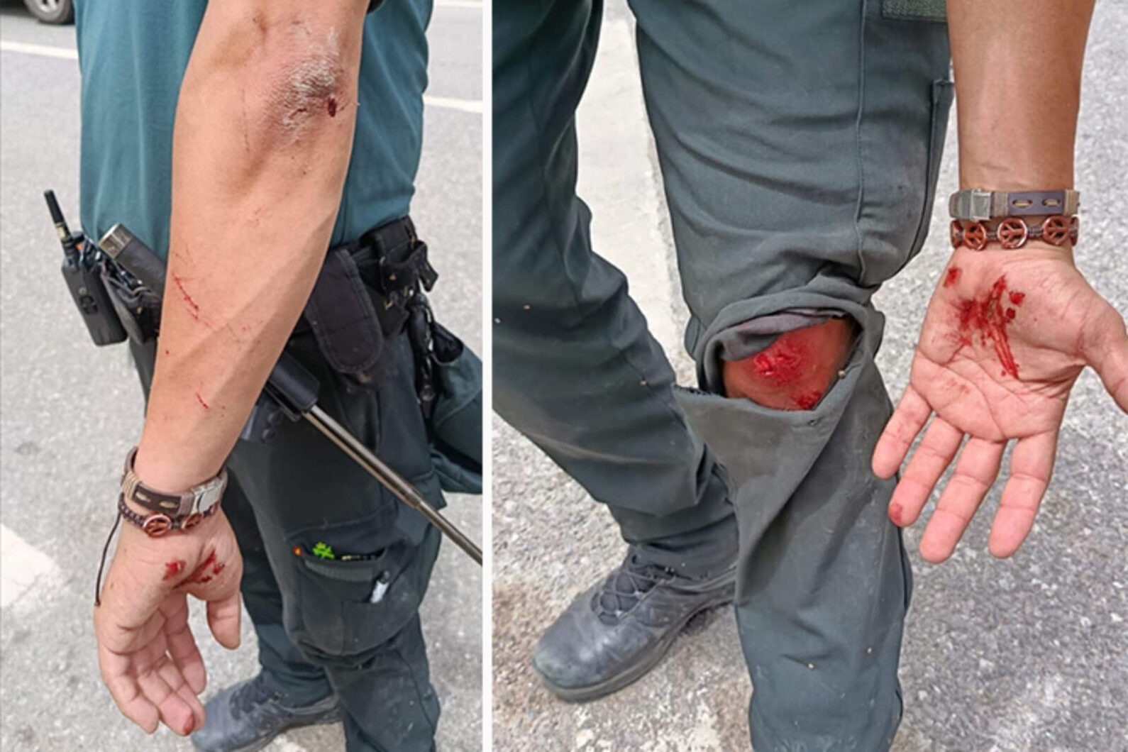agente-guardia-civil-herido-salto-inmigrantes-valla