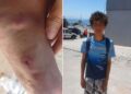 ayuda-urgente-menor-16-anos-posible-osteosarcoma-osteoporosis-1